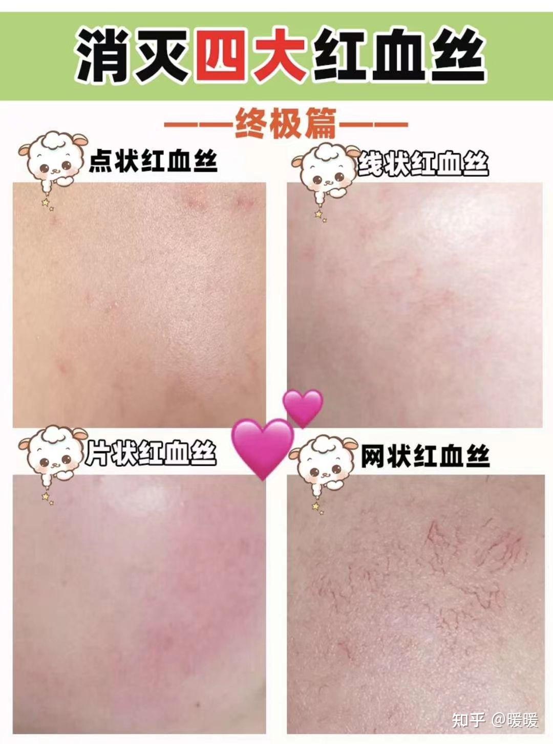 什么是牛头人行为 什么叫做牛头人