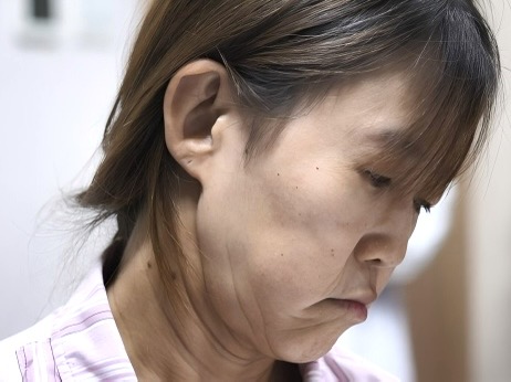 上海伊莱美医疗美容医院公益援助19岁“早衰”少女重拾青春